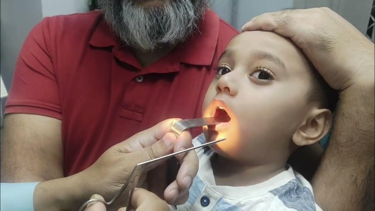 Ear Infections Of Dr. B N Sharma